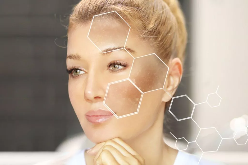 skin whitening treatment