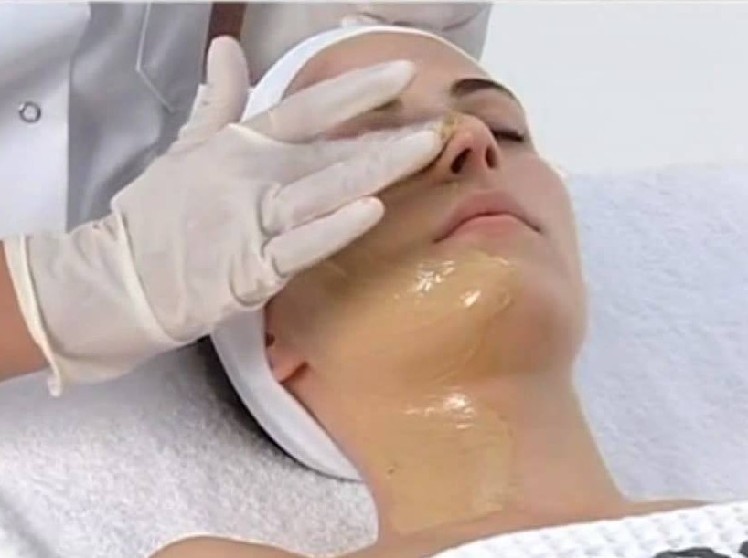 best treatment for melasma on face​